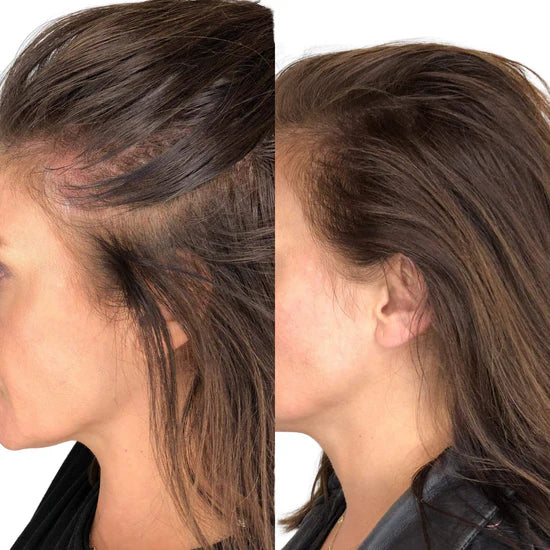 Soléya® - Brosse Stimulante pour le cuir chevelure & la pousse